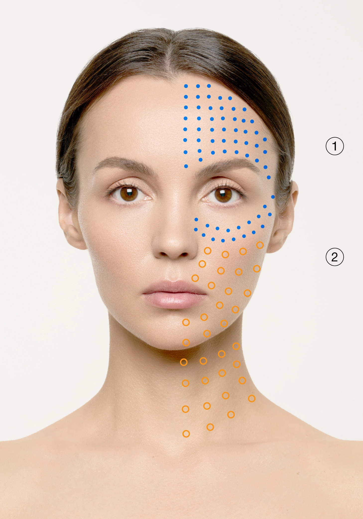 Pigmentation, Rosacea
